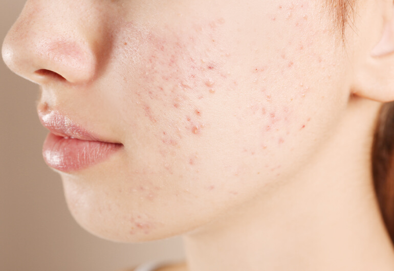 外傷、皮膚疾患